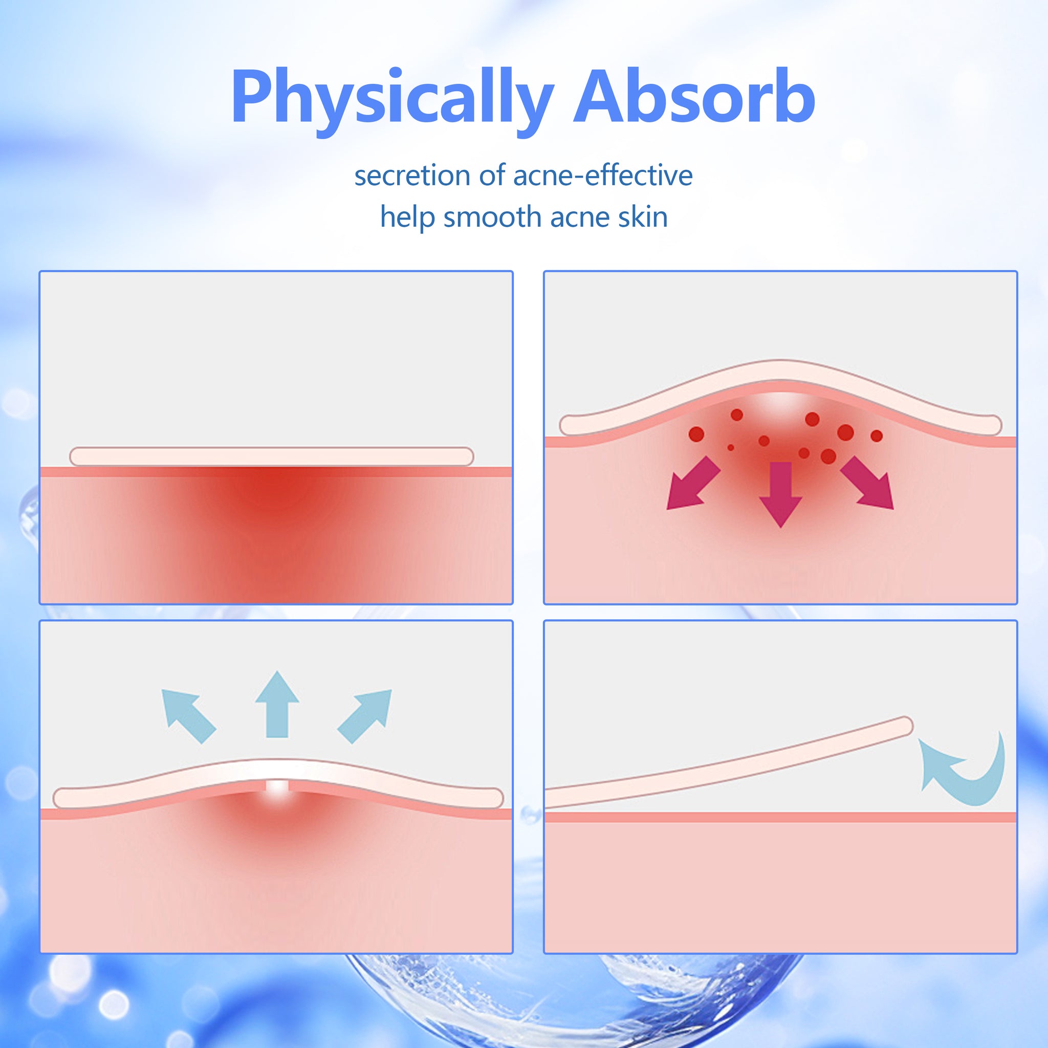 Eidersoft Acne Pimple Patch Disposable Acne Spot Treatment - Eidersoft